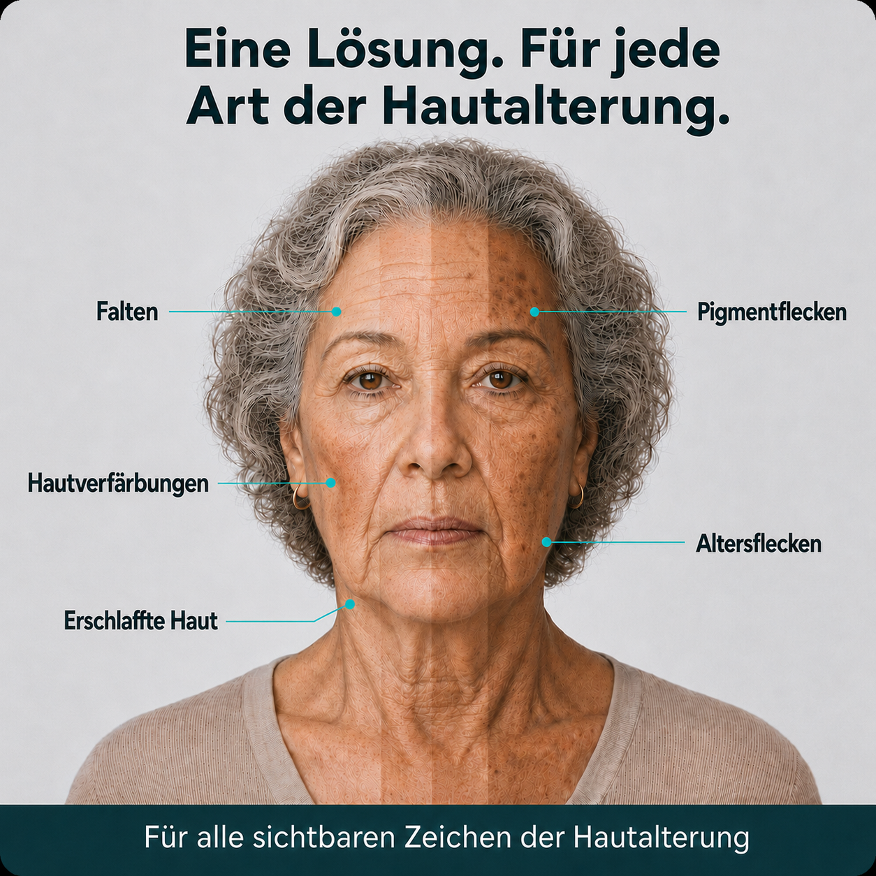 Das Mikro- Infusionssystem™