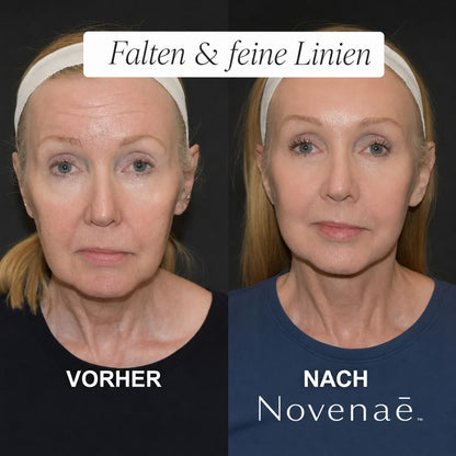 Das Micro- Infusionssystem™